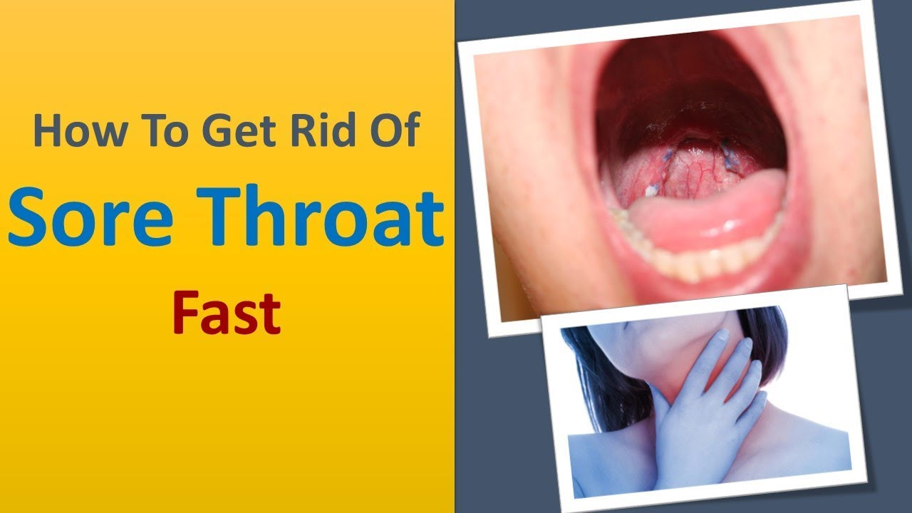 Soothing the Scratch: Remedies and Relief for a Sore Throat